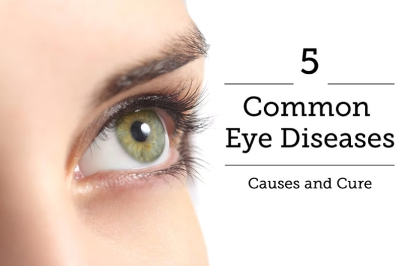 What Are the Five Common Eye Problems?