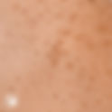 Magnesium and Pigmentation