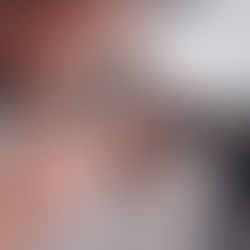 A black and white cat underegoing an eye examination by a veterinarian