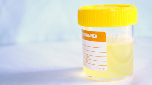 Managing Proteinuria in Cats with Chronic Kidney Disease