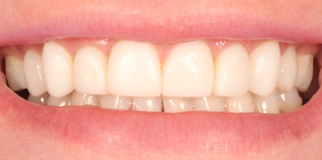 Oakbank Dental, NHS and private dentistry in Perth, Scotland