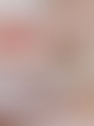 What is Acrylic Resin?