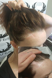 scalp camouflage for woman