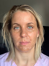 Glowing peel