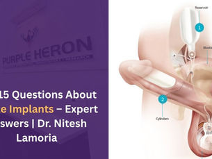Top 15 Questions About Penile Implants – Expert Answers