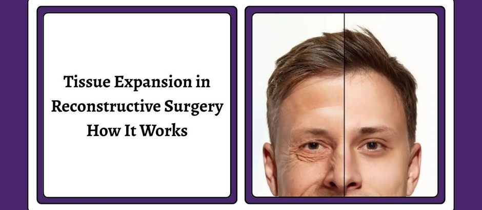Best Reconstructive Surgery Hospital in Jaipur