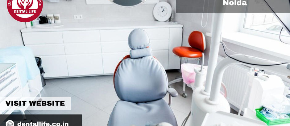 Discover The Best Dental Implants In Noida With Dental Life