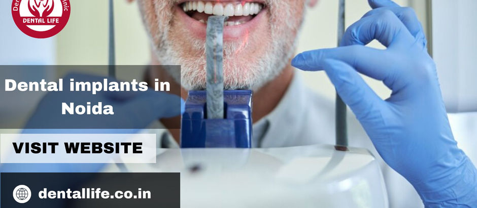 Dental Implants In Noida: Restore Your Smile With Dental Life