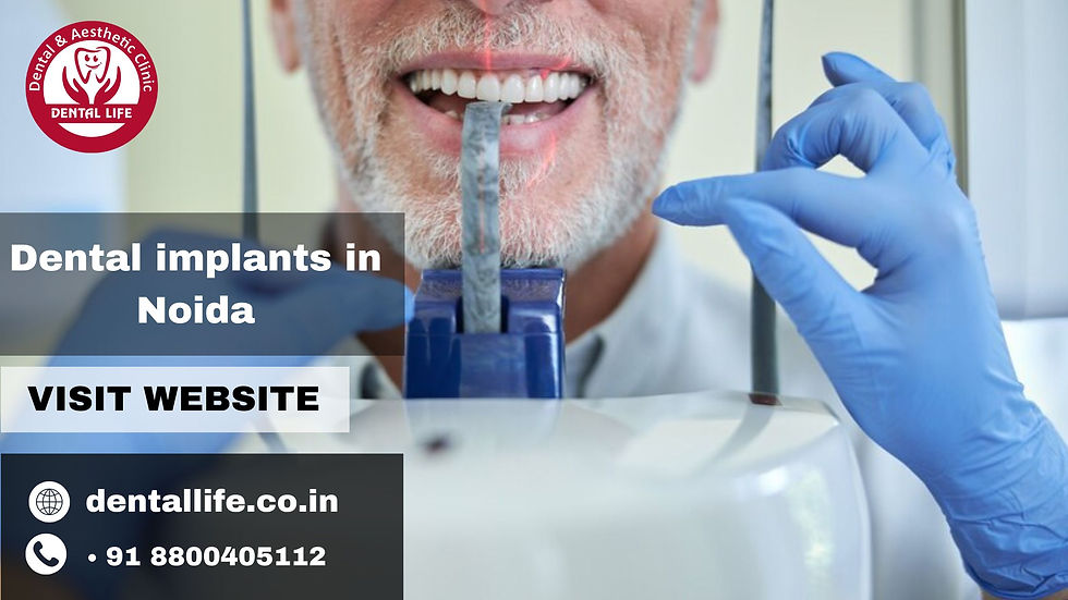 Dental implants in Noida