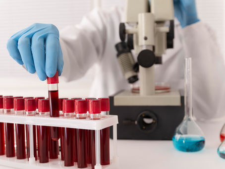 Understanding the Importance of Blood Tests: A Comprehensive Guide for Your Health