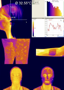 Skin Thermal Imaging analysis of the face and body showing temperature distribution and localized thermal variations for cosmetic and dermatological research.