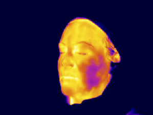 Infrared skin thermal imaging of the face showing variations in skin surface temperature and facial heat distribution.