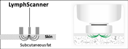 LymphScanner and TDC
