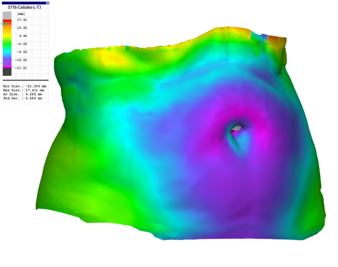 3D slimming product effect capture and analysis