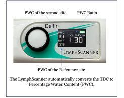 LymphScanner screen