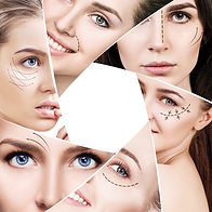 MULTI-ANGLE SHOTS