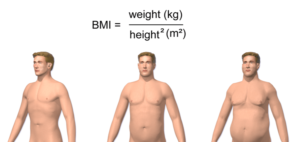 BMI <25 (left), 25-29 (middle), >30 (right). ©Bruce Blaus/Wikimedia