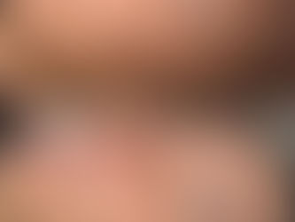 男性の毛穴悩みはなぜ起こる?原因と毎日のスキンケア習慣