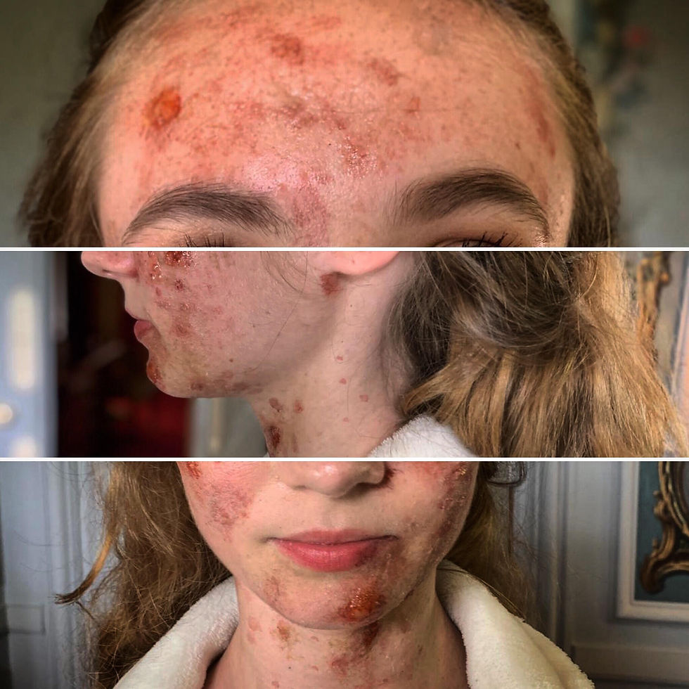 Prosthetic Makeup Design and Application
