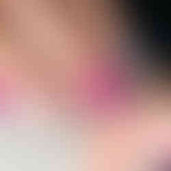 Unghie fucsia con pattern zebrato bianco e nero e fiorellini rosa e fucsia come decorazione