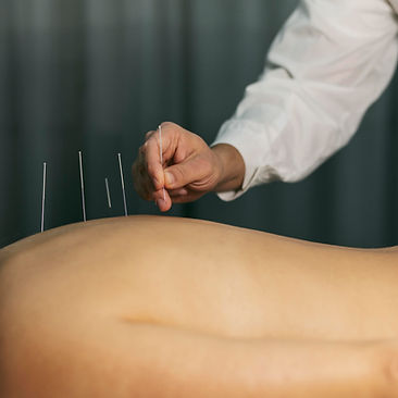 acupuncture-process