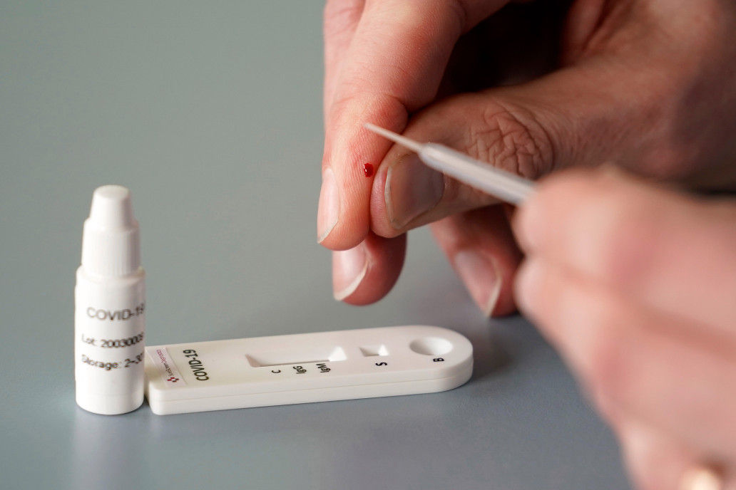 COVID-19 Rapid Antibody At Home Test
