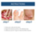 Thumbnail: Anti Fungal Nails Repair Gel Onychomycosis Infection Repair Bleeding Yellowing 