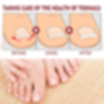 Thumbnail: Anti Paronychia Relief Oil Ingrown Toenail Drops Anti Fungal Toe Nail Ingrown C
