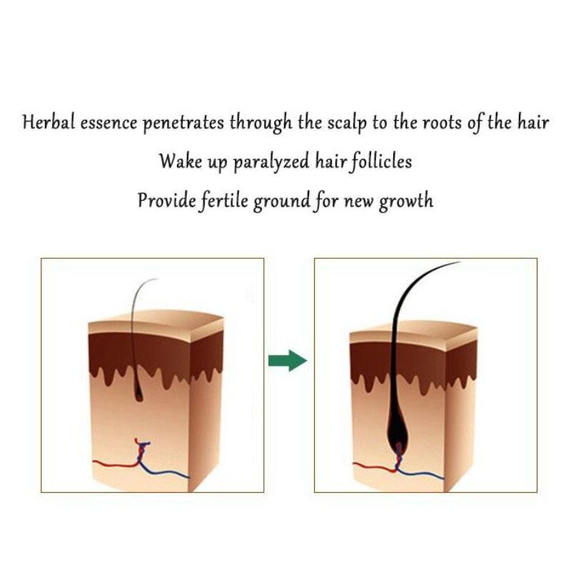 Thumbnail: Ginger Root Hair Nutrient Solution Hair Growth Essential Oil Anti-hair Loss Gin