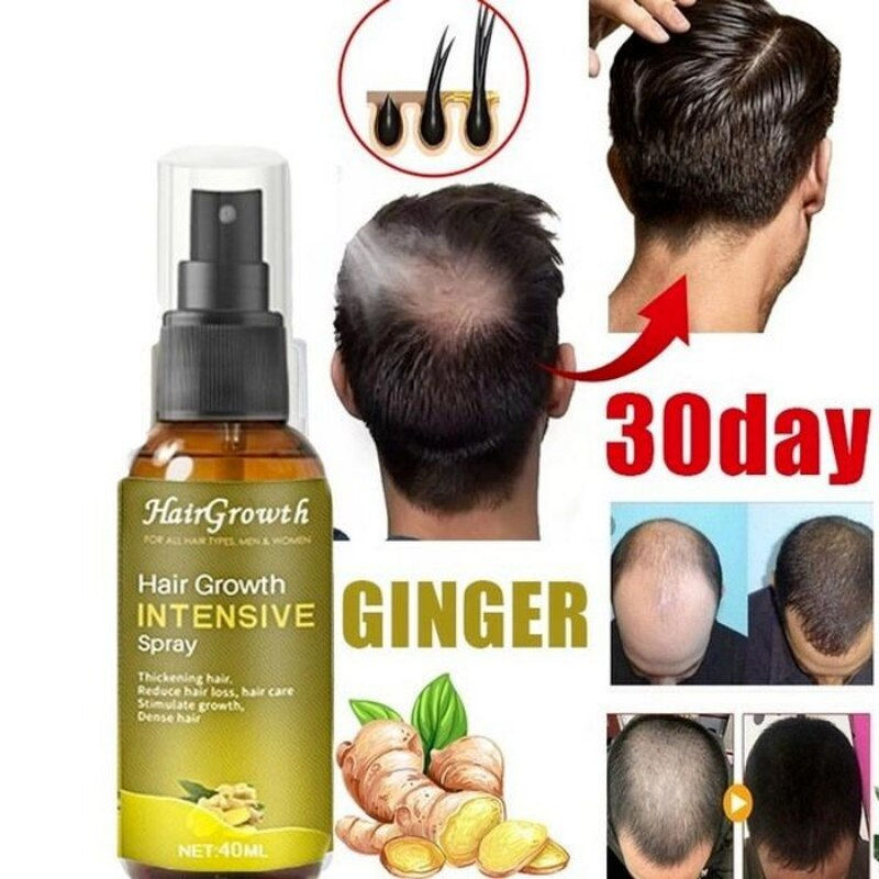 Thumbnail: Hair Growth Essence Oil/beauty Hair Growth Liquid/fast Hair Growth Spray Hair T