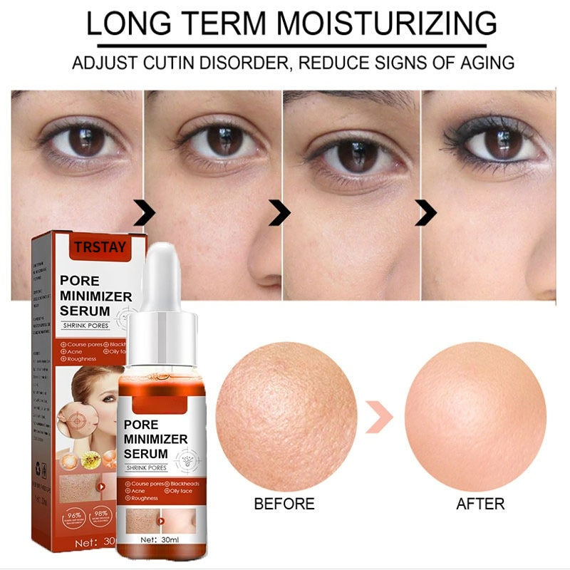 Thumbnail: Salicylic Acid Shrink Pores Facial Serum Firm Moisturizing Essence Liquid Repai