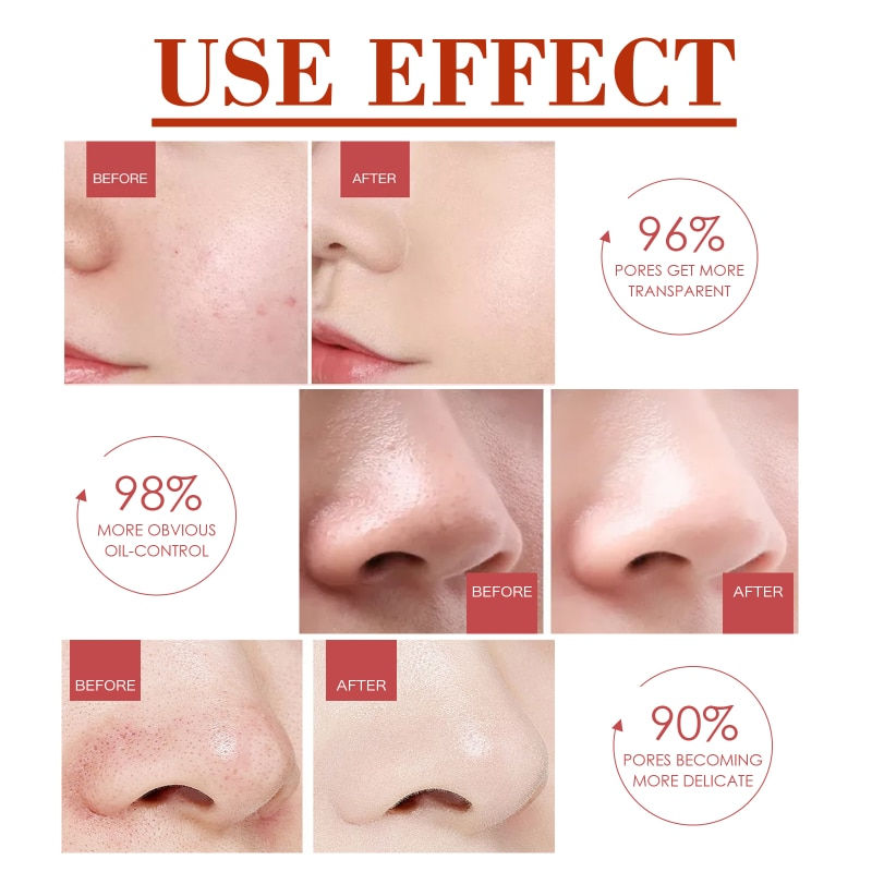 Thumbnail: Salicylic Acid Shrink Pores Facial Serum Firm Moisturizing Essence Liquid Repai