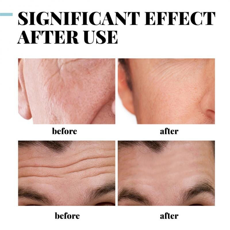 Thumbnail: Collagen Anti Wrinkle Creams for Men Hyaluronic Acid Vitamin E Cream Beauty Fad