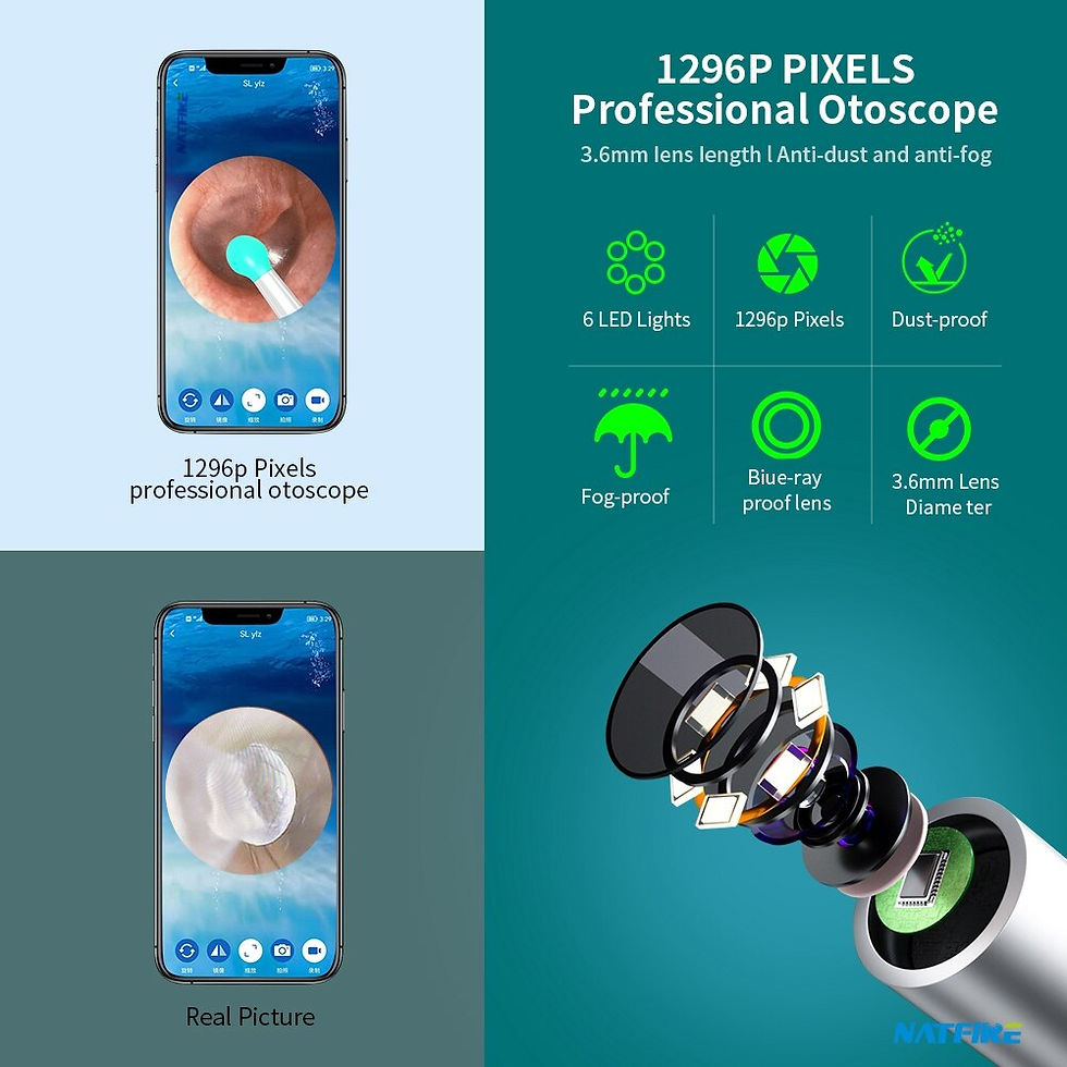 Thumbnail: NATFIRE Wireless Ear Wax Remover Luminous Otoscope Ear Cleaner 1296P HD Visual 