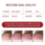 Thumbnail: Anti Paronychia Relief Oil Ingrown Toenail Drops Anti Fungal Toe Nail Ingrown C