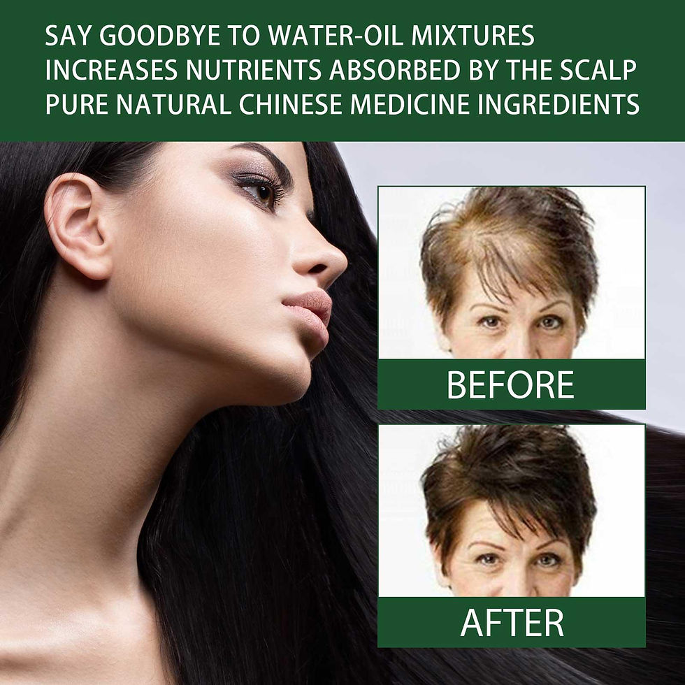 Thumbnail: Hair Growth Hair Care Essential Oil 30ml Ginger Hair Growth Hair Lose Hair Seru