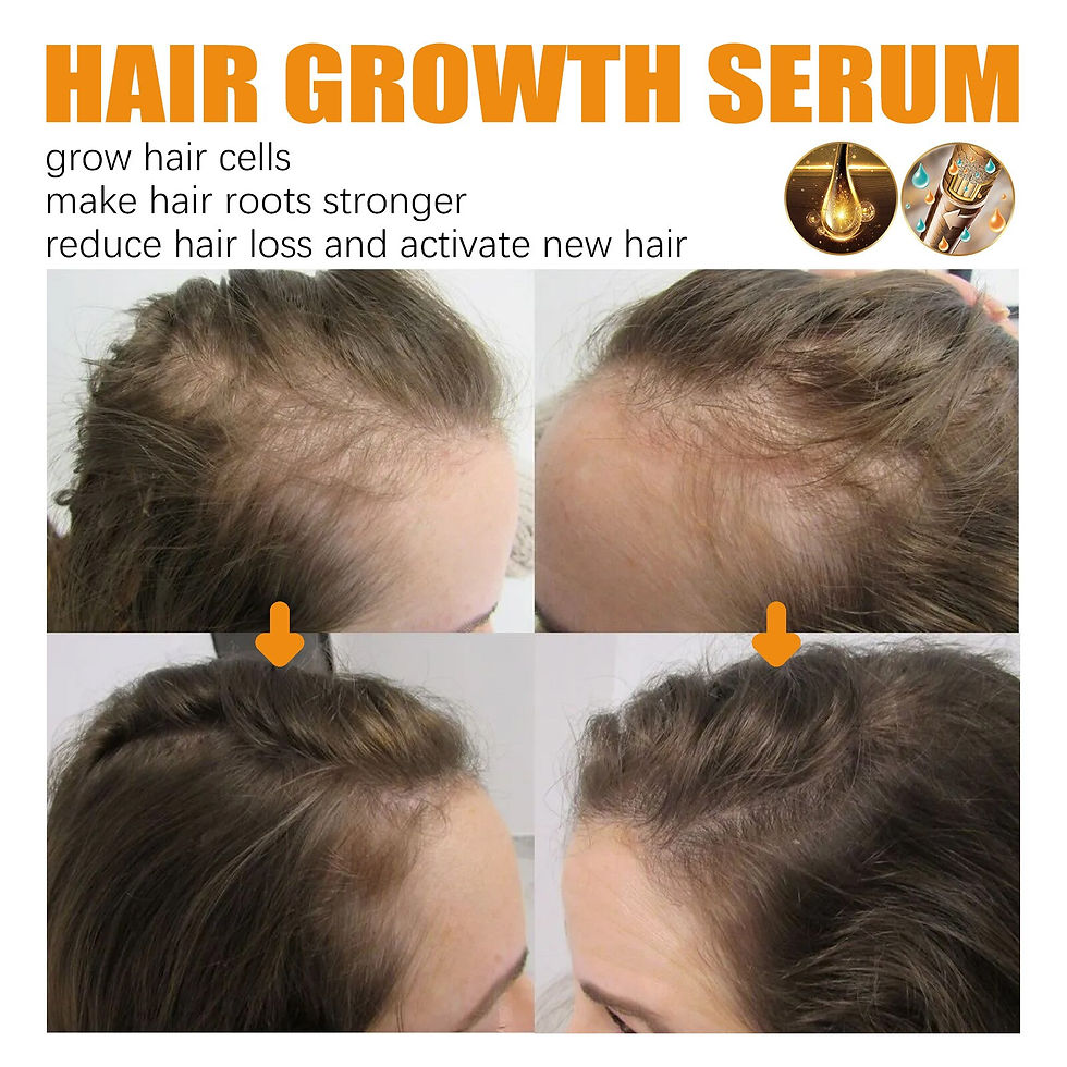 Thumbnail: Anti Alopecia Fast Hair Growth Oil Essential Oils Essence Anti Loss Bald Treatm