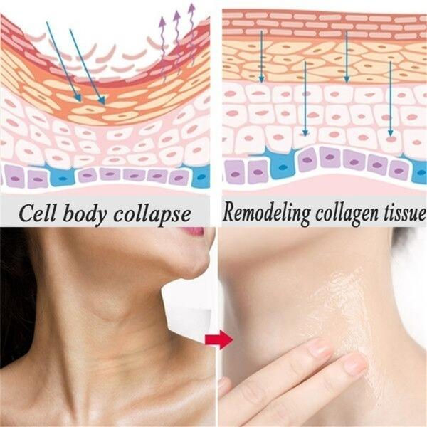 Thumbnail: Neck Firming Cream, Anti Aging Moisturizer for Neck , Double Chin Reducer, Skin