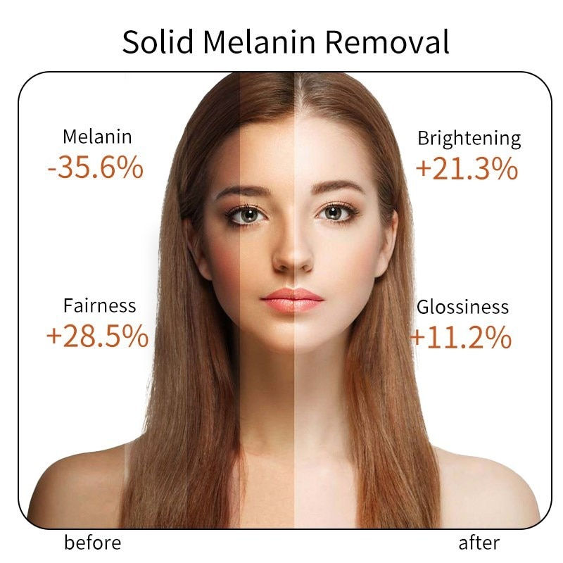 Thumbnail: Natural Vitamin Serum Original Face Dark Spot Whitening Brighten Moisturizing V