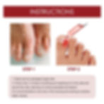 Thumbnail: Anti Paronychia Relief Oil Ingrown Toenail Drops Anti Fungal Toe Nail Ingrown C