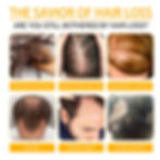 Thumbnail: Anti Alopecia Fast Hair Growth Oil Essential Oils Essence Anti Loss Bald Treatm