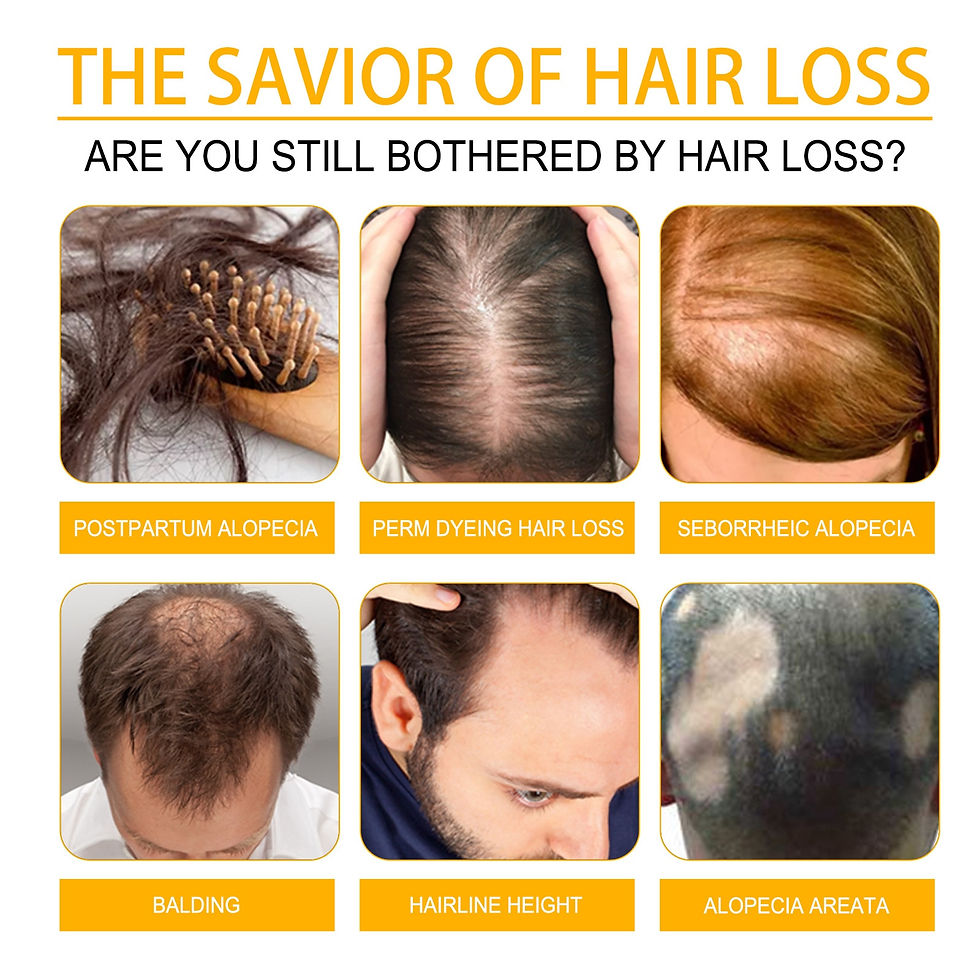 Thumbnail: Anti Alopecia Fast Hair Growth Oil Essential Oils Essence Anti Loss Bald Treatm