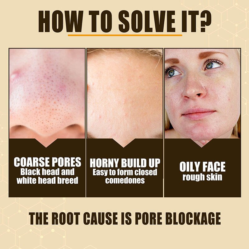 Thumbnail: Pore Shrinking Serum Skin Elasticity Delicate Repair Essence Clean Blackheads A