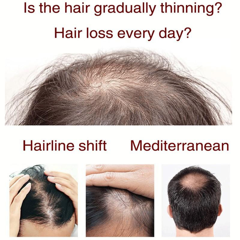 Ginger Herbal Shampoo Hair Growth Anti-hair Loss Anti-itch Anti-dandruff Oil-co