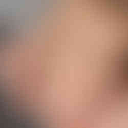 Anello solitario in oro bianco con diamante taglio cuore eccellente qualità da 2,20 ct perfetto come anello di fidanzamento