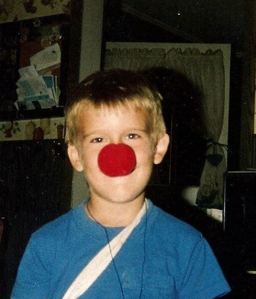 Young boy wearing a red clown nose and arm sling