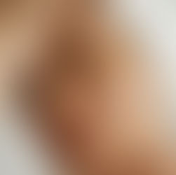 Óleo hidrata a pele? A dúvida mais polêmica do skincare