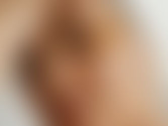 Óleo hidrata a pele? A dúvida mais polêmica do skincare
