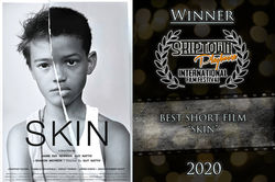 SKIN-BESTSHORTFILM