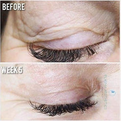 non-surgical-facelift.jpeg